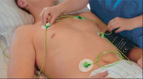 【One-line ECG Lead Wires】Patent Technology, Avoiding Tangle, Make Patients More Comfortable