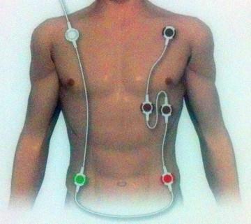 【One-line ECG Lead Wires】Patent Technology, Avoiding Tangle, Make Patients More Comfortable