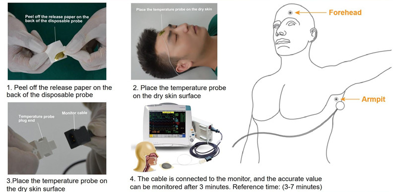 The difference between disposable Skin-surface temperature probes and Esophageal /Rectal temperature probes