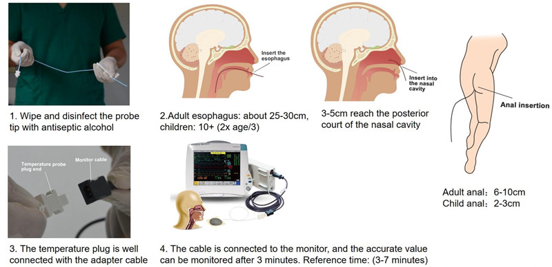 The difference between disposable Skin-surface temperature probes and Esophageal /Rectal temperature probes