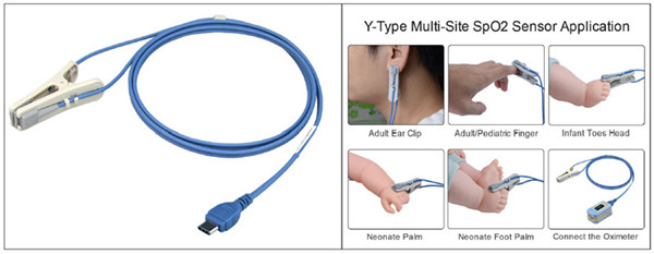 Medlinket's Y-type multi-site SpO2 probe, a small expert in clinical home-based measurement