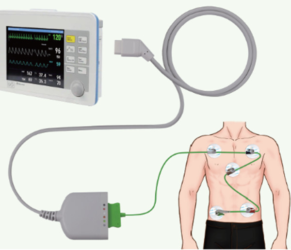 Medlinket's One-Piece ECG Cable with LeadWires is fast, easy to use and convenient to lead